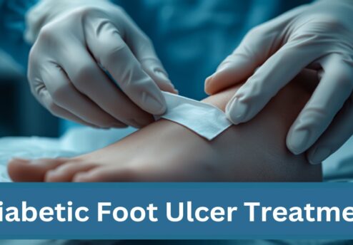 Diabetic Foot Ulcer Treatment — Featured Image